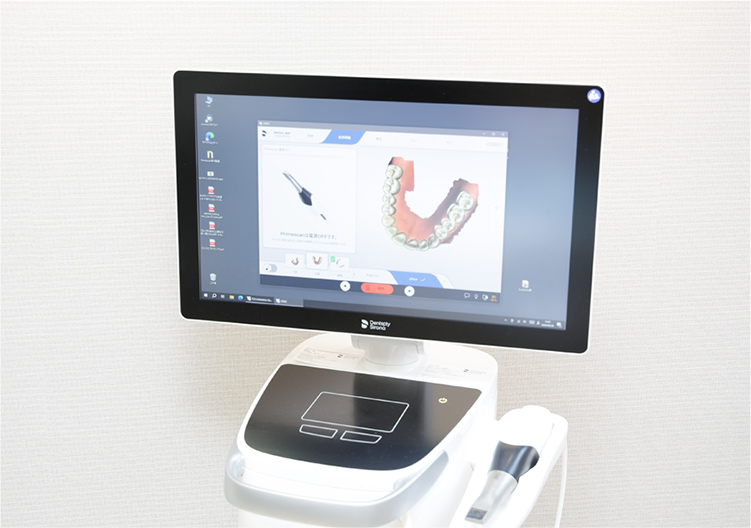 快適な歯型取りができる口腔内スキャナー